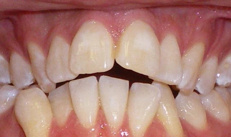 before Image