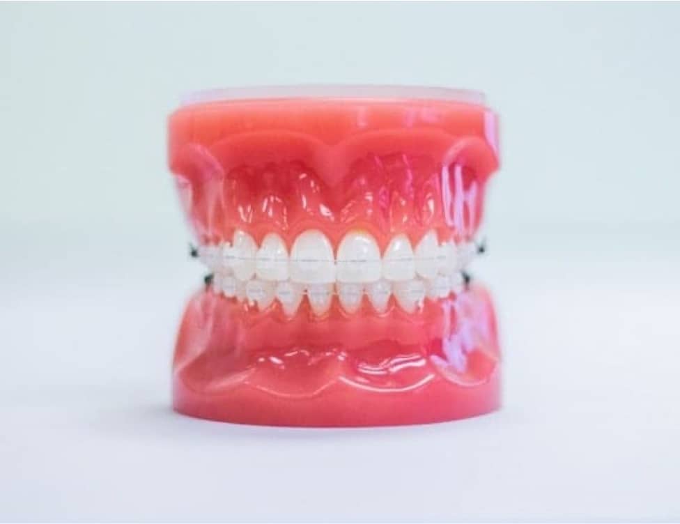 clear ceramic braces on plastic model