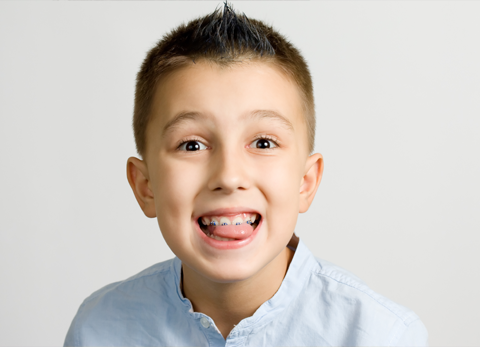 kids-treatment-limited Lake Oswego Orthodontics