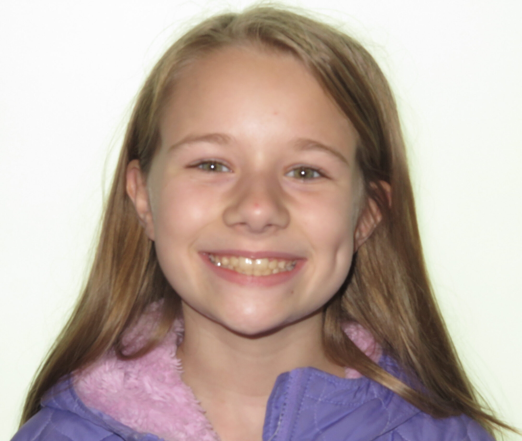 orthodontics for children