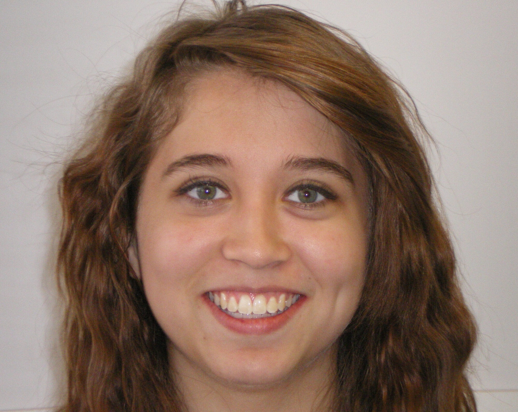 teen orthodontics lake oswego