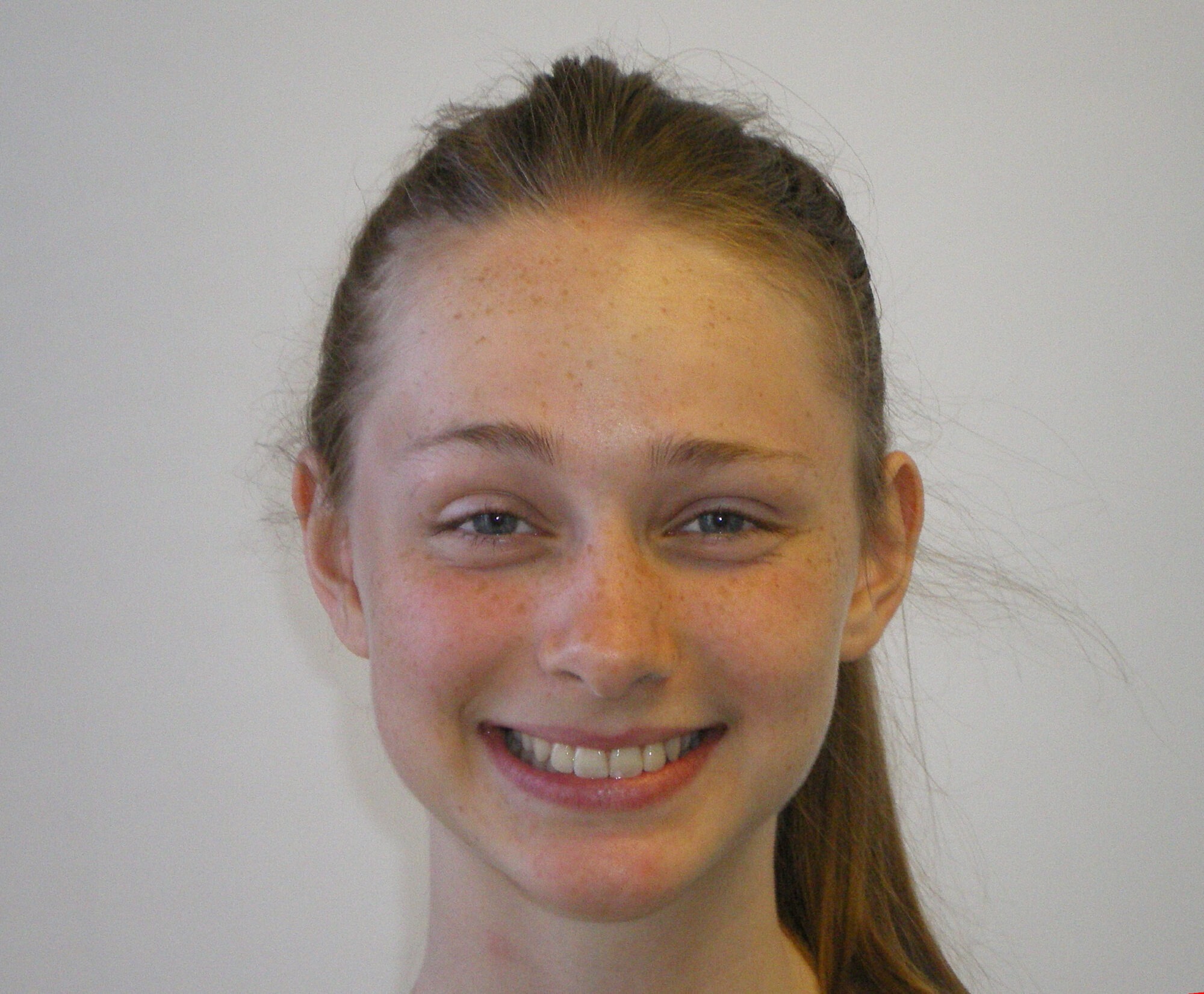 lake oswego teen orthodontics
