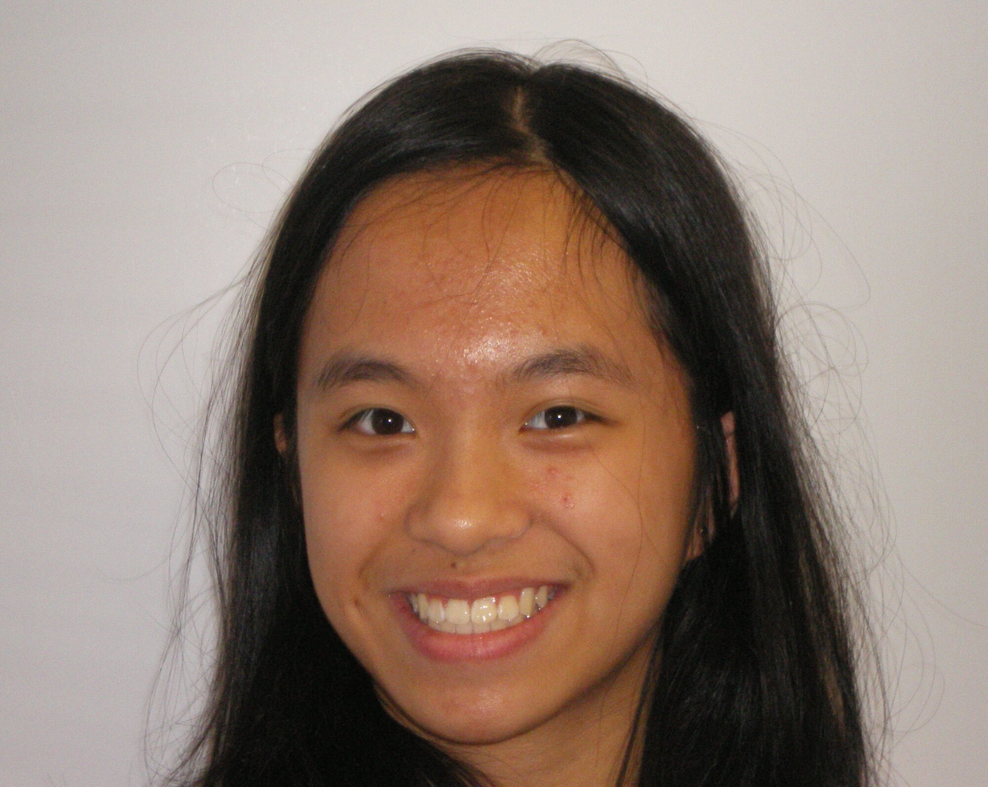 Orthodontics for teens beaverton