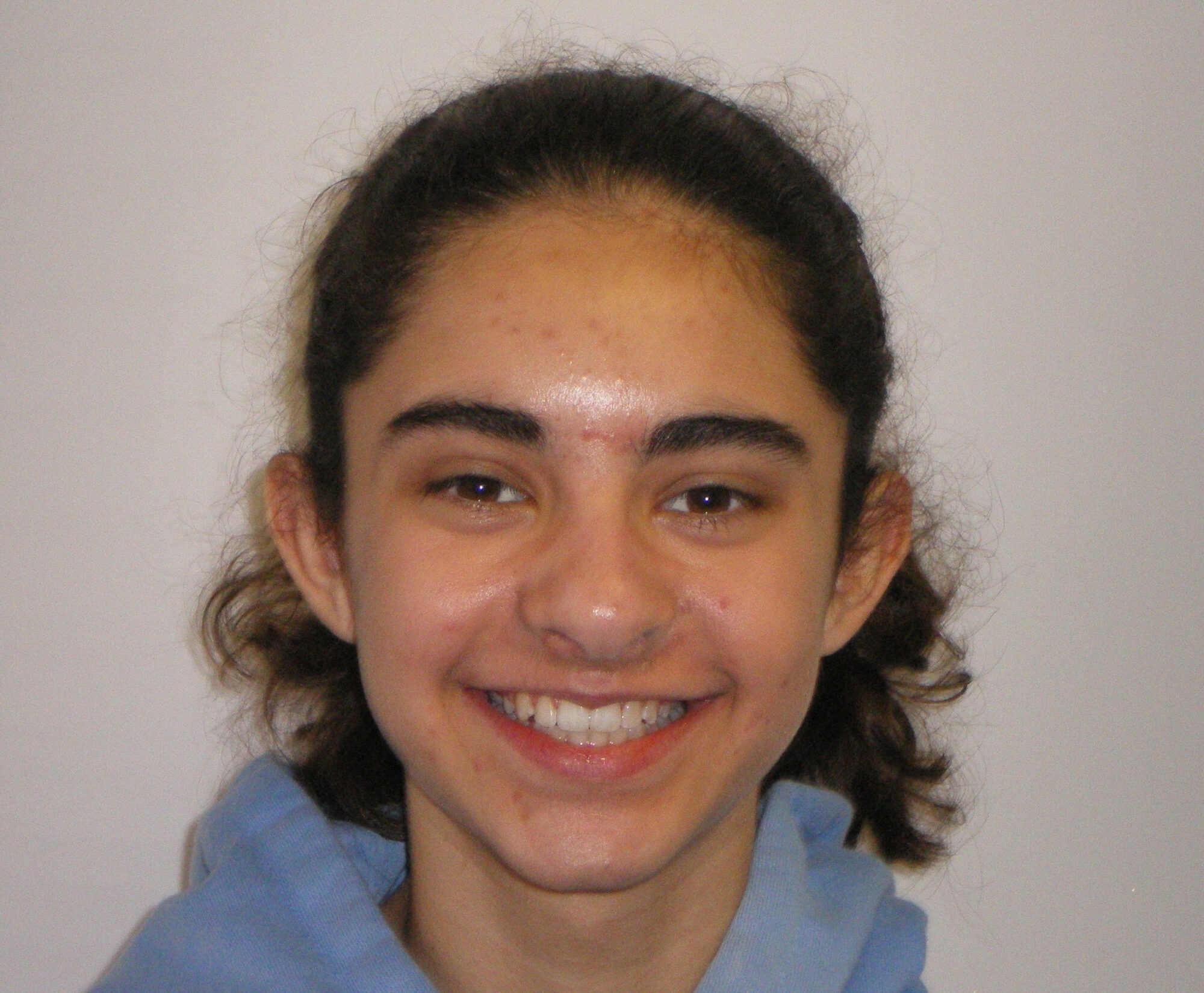 Orthodontics for teens lake oswego