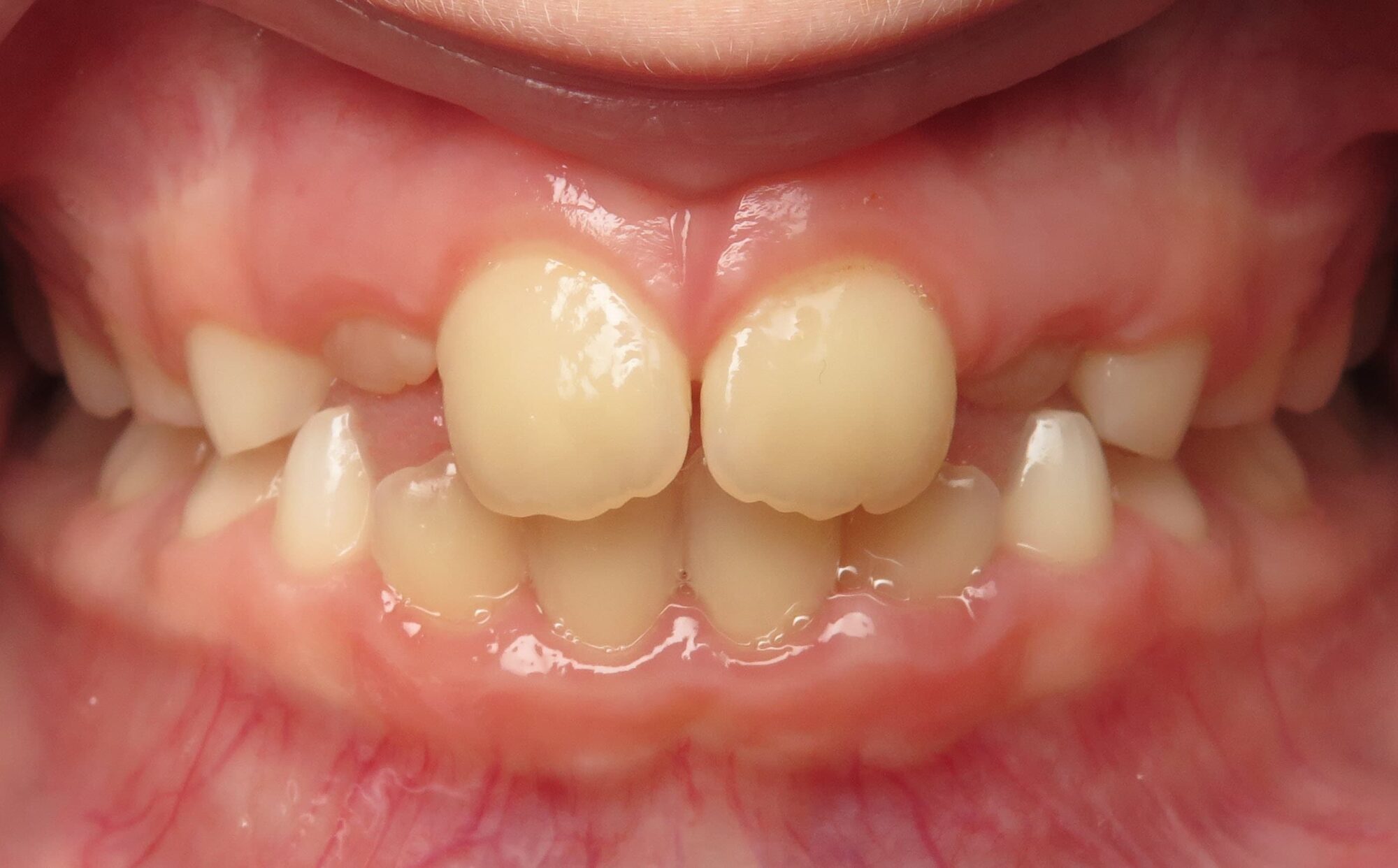 before Image