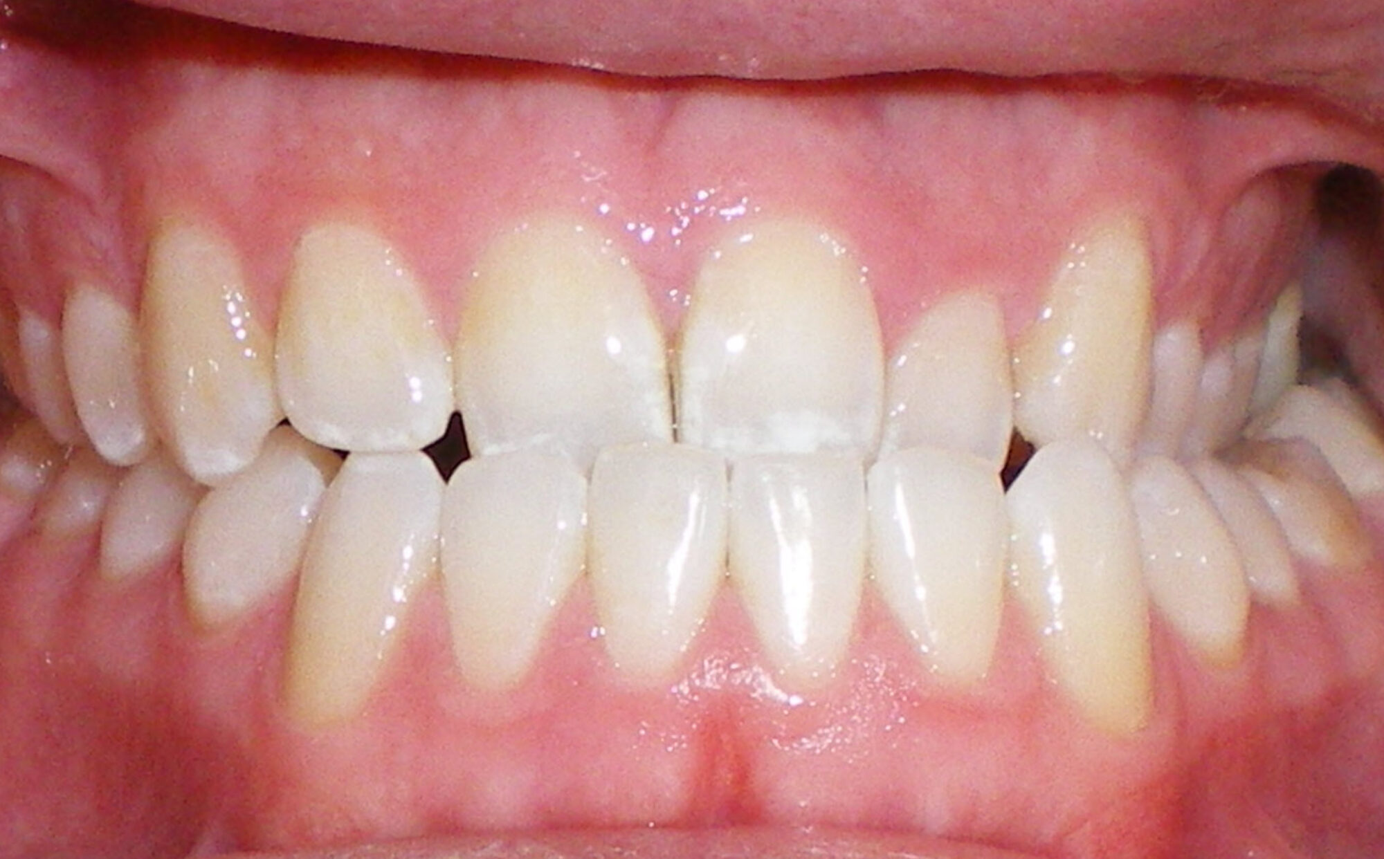 before Image