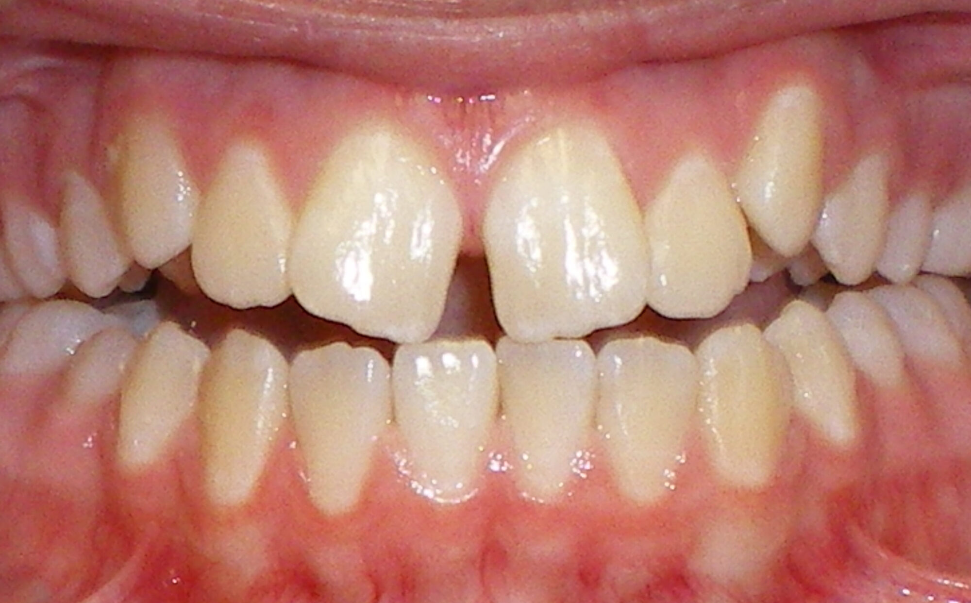 before Image
