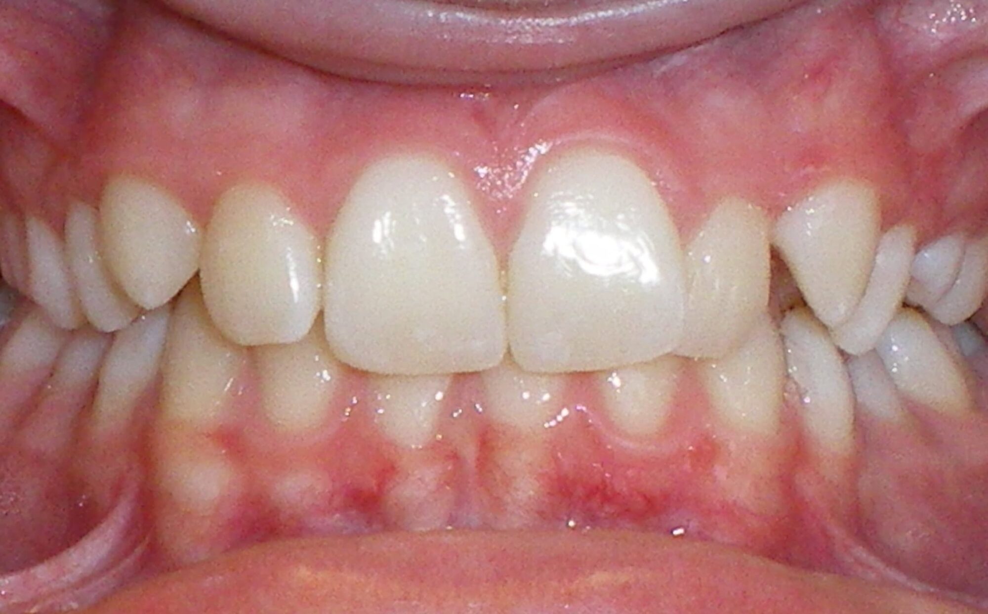 before Image