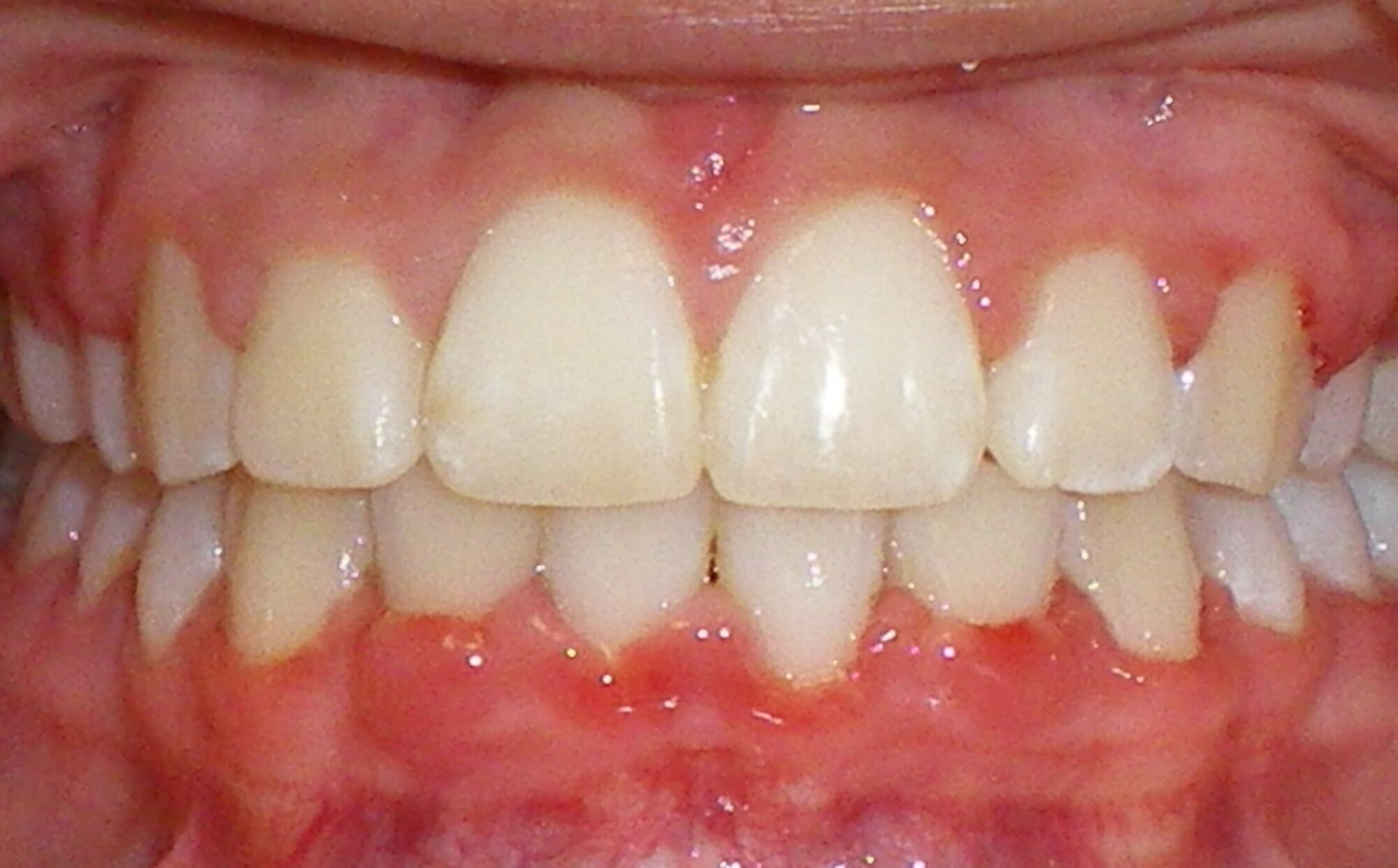 after Image