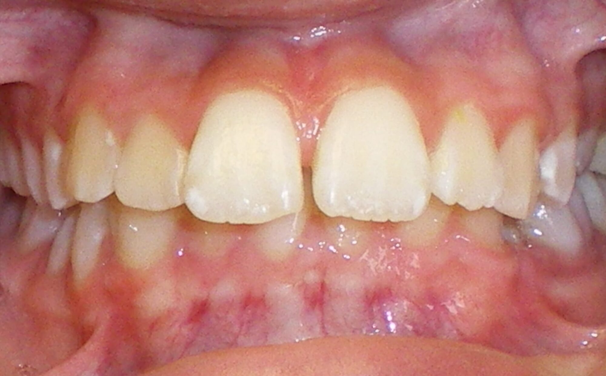 before Image