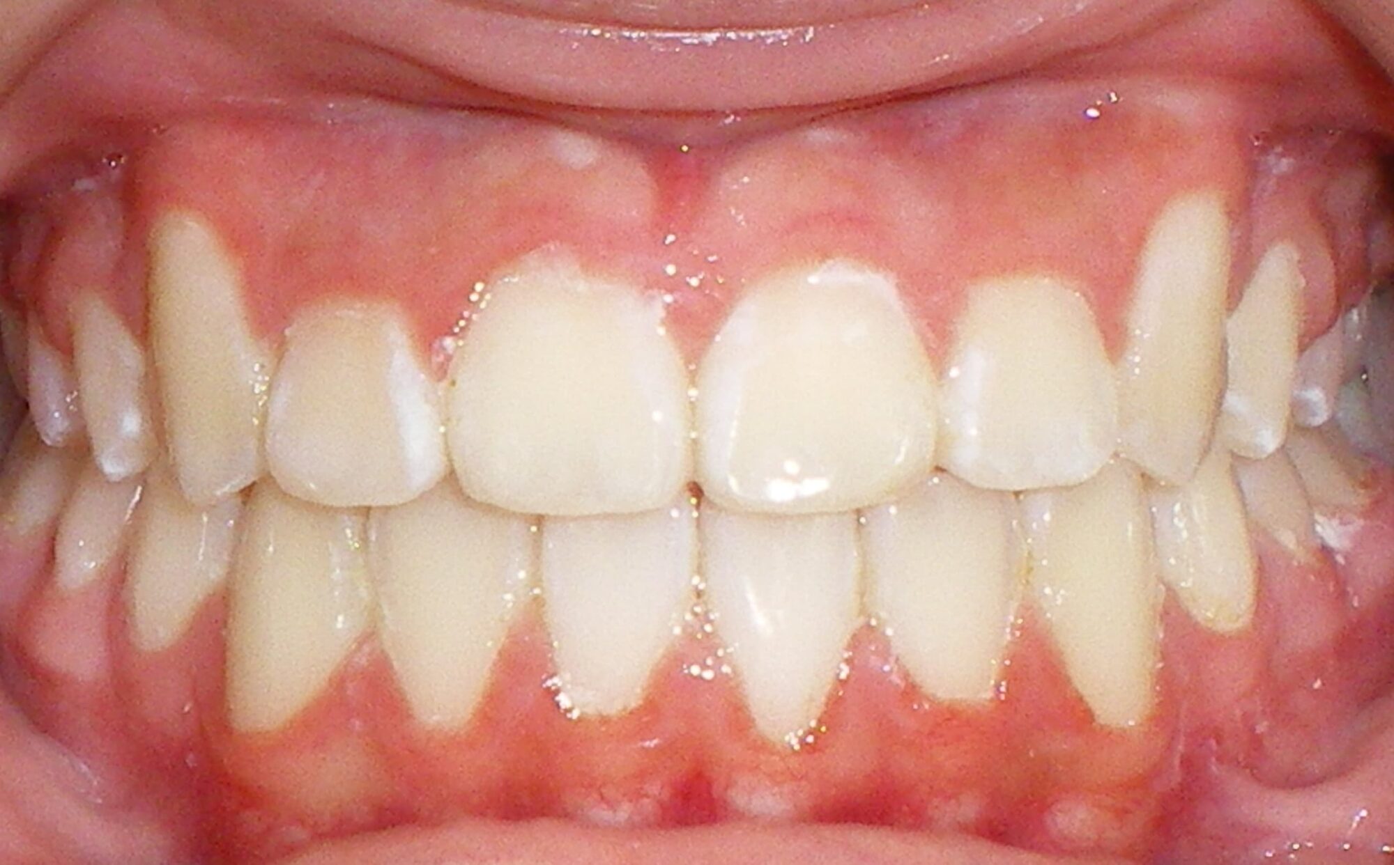 after Image