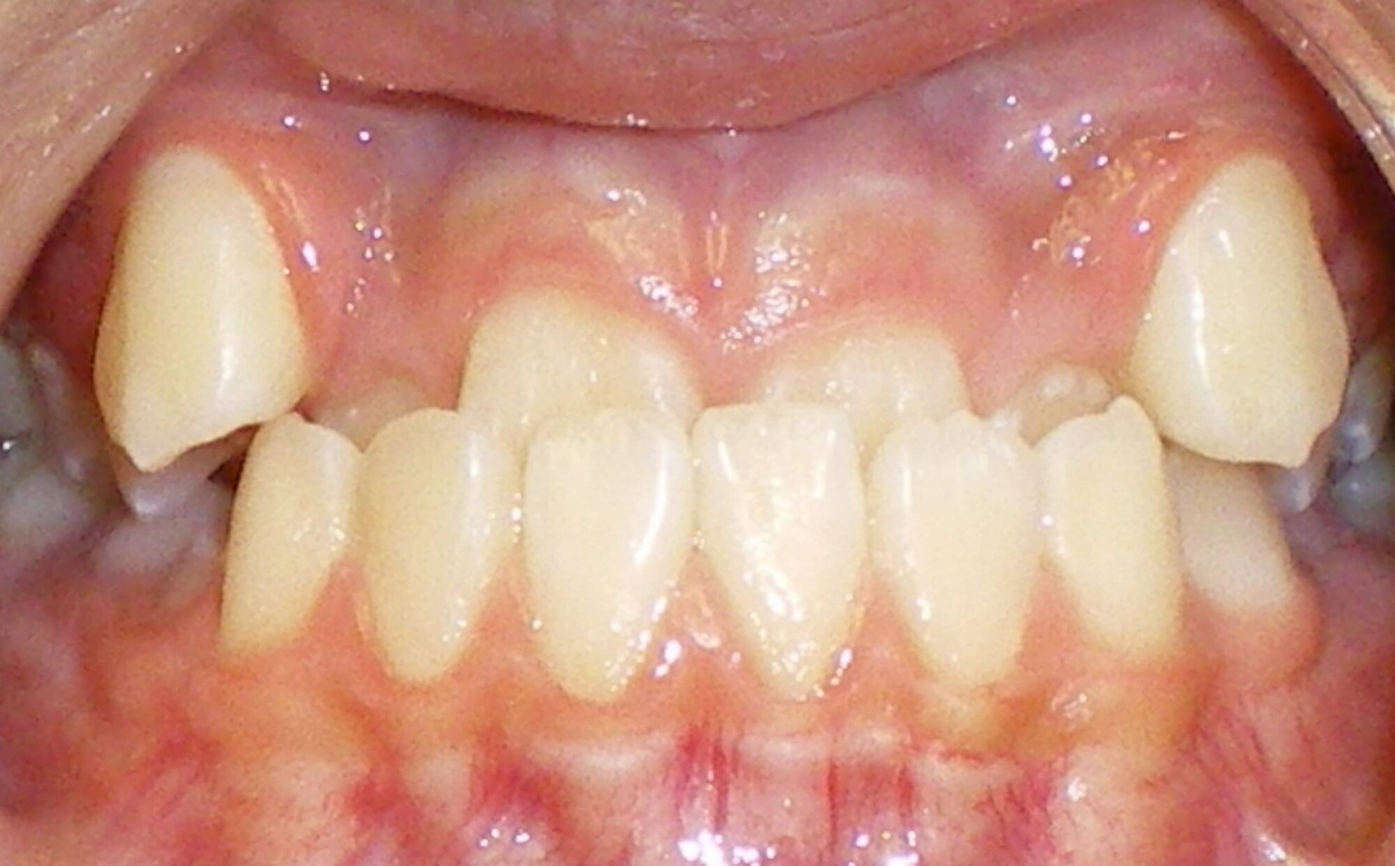before Image