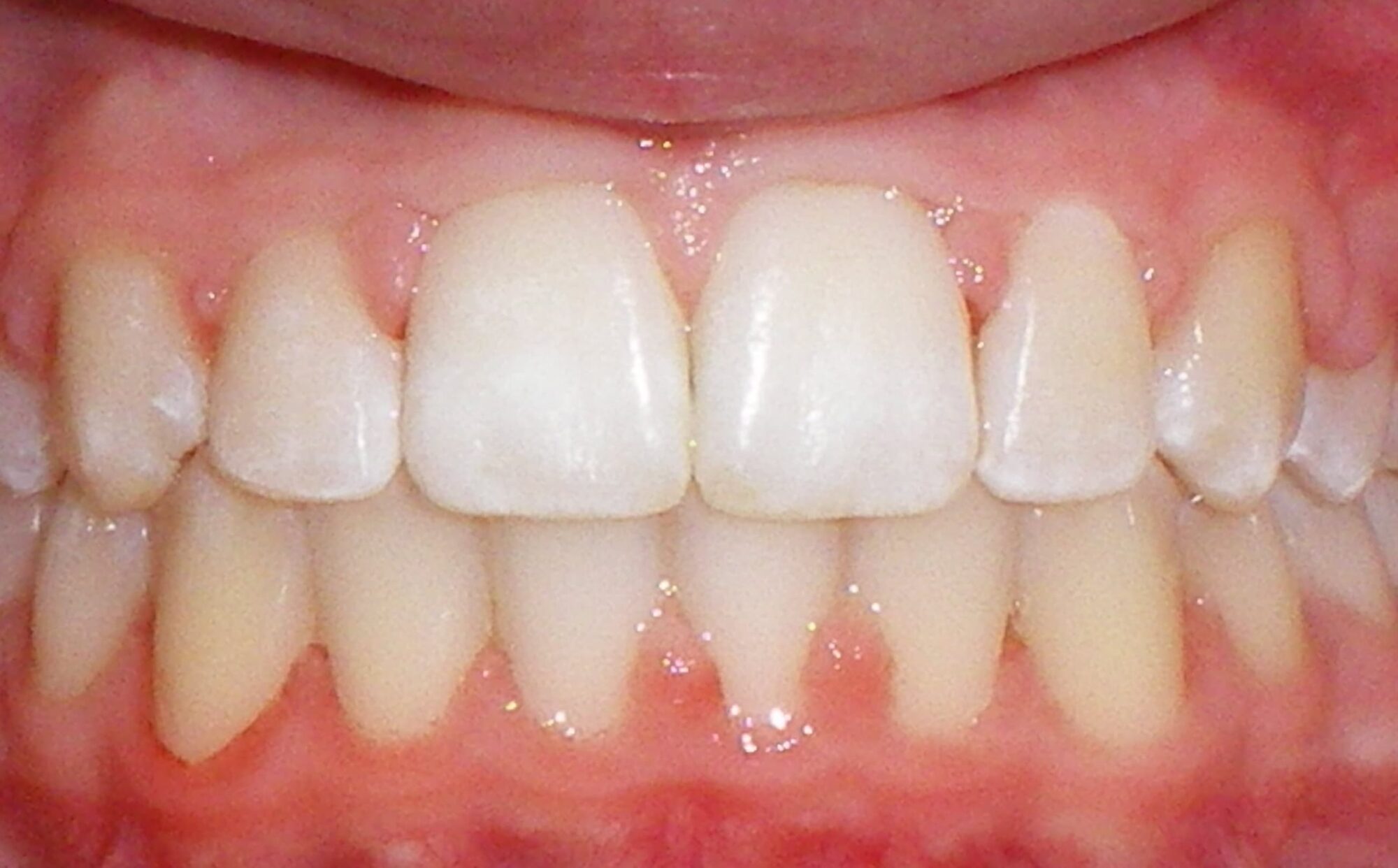 after Image